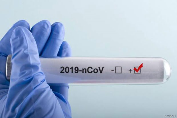 Covid 19 POZITIVAN NALAZ
